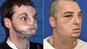 metamosxeusi_prosopou76548