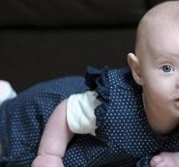 Γεννήθηκε χωρίς αίμα και επέζησε!