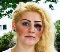 Ξυλοκόπησαν Ελληνίδα στο Βερολίνο επειδή πανηγύρισε το γκολ της Εθνικής μας!