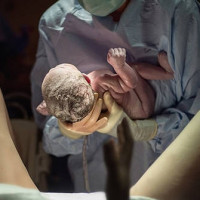 Το θαύμα της φύσης! Ασύλληπτες φωτογραφίες πριν και μετά τη γέννα