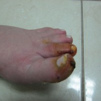 Πτολεμαΐδα: Λαχτάρα για έγκυο στον 9ο μήνα – Ανατριχιαστικές εικόνες μετά τον αναπάντεχο τραυματισμό της