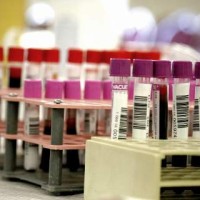 ΚΕΕΛΠΝΟ: 65 κρούσματα ελονοσίας μέσα στο 2016 στην Ελλάδα, τα 61 εισαγόμενα – Δείτε αναλυτικά