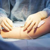 Πώς μπορείς να καταλάβεις εάν έχεις κιρσούς ή ευρυαγγείες;