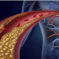 Χοληστερίνη και τριγλυκερίδια – Της ειδικής παθολόγου Σοφίας Χριστάκη