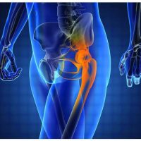 Αρθροσκόπηση: Ποιες παθήσεις αντιμετωπίζονται αρθροσκοπικά;