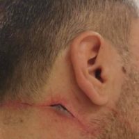 Θεσσαλονίκη: Οι φωτογραφίες από την επίθεση και τον τραυματισμό δύο αστυνομικών στο περιπολικό